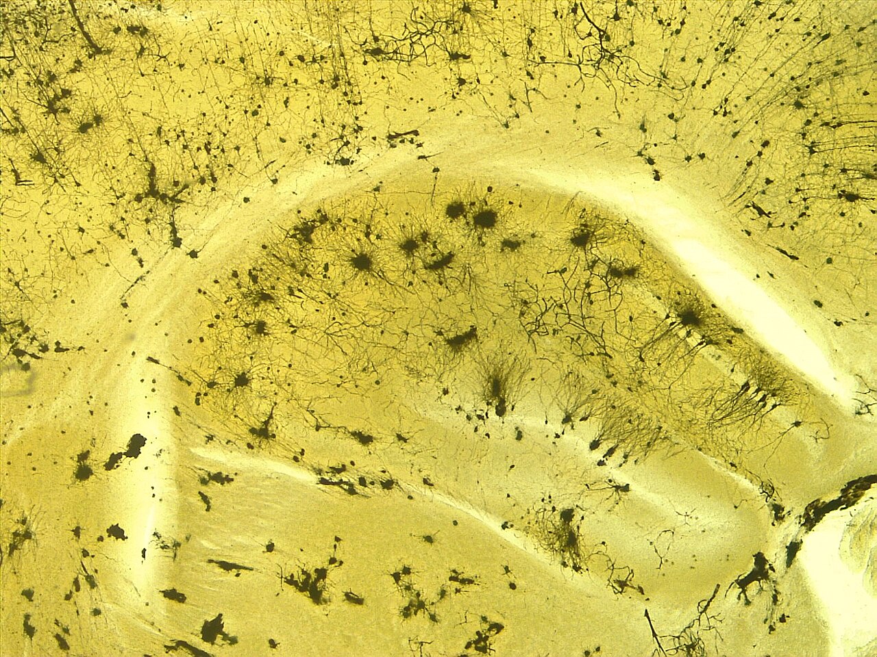 Sección teñida del hipocampo de un ratón, con neuronas visibles al microscopio (imagen de archivo)